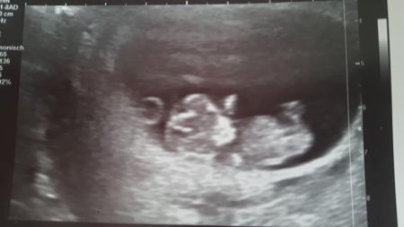 Bild zu Zurück von Der FÄ - Forum für August - Mamis