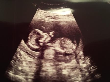 Bild zu Hatte auch FA Termin - Forum für August - Mamis