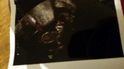 Bild zu Krümele hat gewunken :D - Forum für August - Mamis