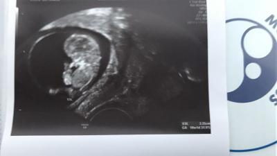 Bild zu Zurück vom fa :) - Forum für August - Mamis