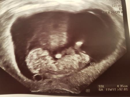 Bild zu Zurück von der FÄ und Überraschung :-) - Forum für August - Mamis