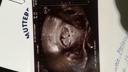 Bild zu FA-Termin heute - Forum für August - Mamis