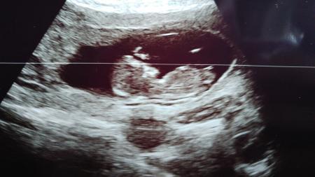 Bild zu Zurück vom Ersttrimesterscreening.. - Forum für August - Mamis