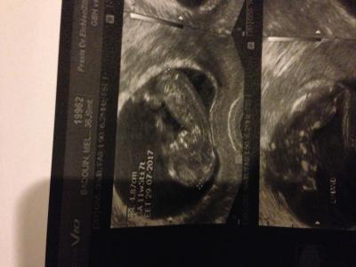 Bild zu Ein Update von mir, könnte länger werden - Forum für August - Mamis