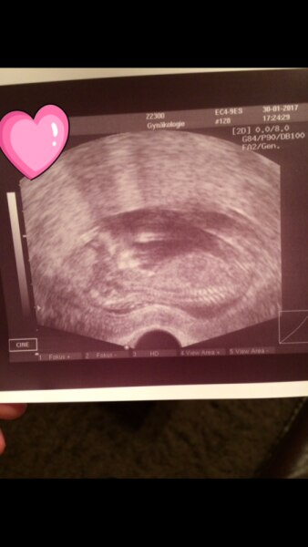 Bild zu FA Termin - Forum für August - Mamis