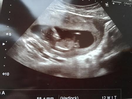 Bild zu Zurück vom FA - Forum für August - Mamis