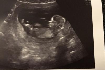 Bild zu Zurück vom fa - Forum für August - Mamis