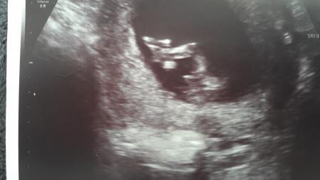 Bild zu Geschlecht.. - Forum für August - Mamis