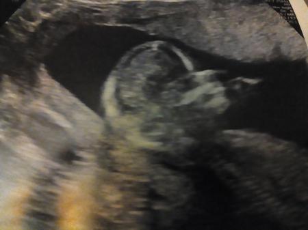 Bild zu Das schönste Valentinstagsgeschenk... - Forum für August - Mamis