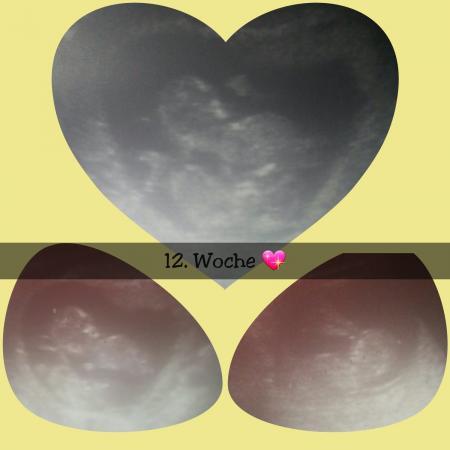 Bild zu FA Bericht - Forum für August - Mamis