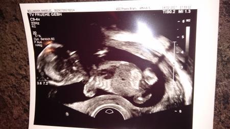 Bild zu outing - eure meinung - Forum für August - Mamis