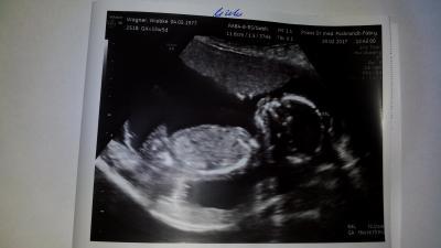 Bild zu Auch zurück von der Frauenärztin - Forum für August - Mamis