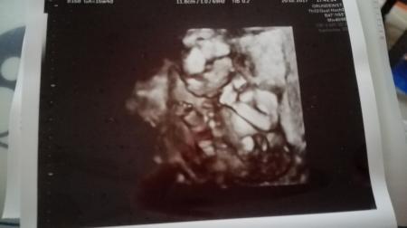 Bild zu Unglaubliche Freude < 3 - Forum für August - Mamis