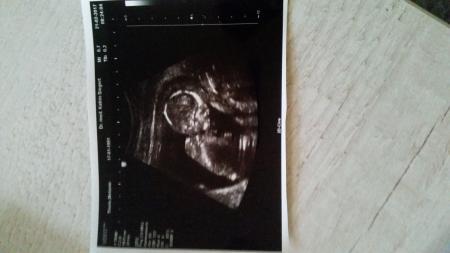 Bild zu FA-Termin - Forum für August - Mamis