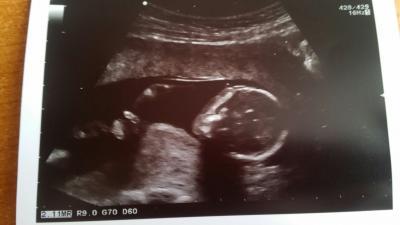 Bild zu Neu hier und gleich eine Frage an euch, zurück vom FA :) - Forum für August - Mamis