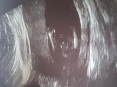 Bild zu Hilfe was seht ihr Mädchen oder junge? - Forum für August - Mamis