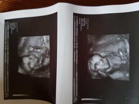 Bild zu Zurück vom Fa..... - Forum für August - Mamis