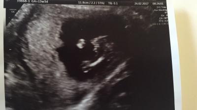 Bild zu FA Termin - Forum für August - Mamis