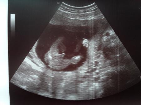 Bild zu Outing - Forum für August - Mamis