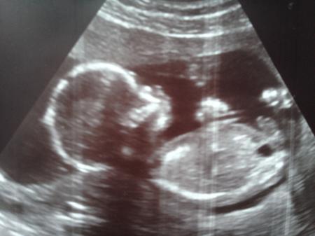 Bild zu zweites Bild - Forum für August - Mamis