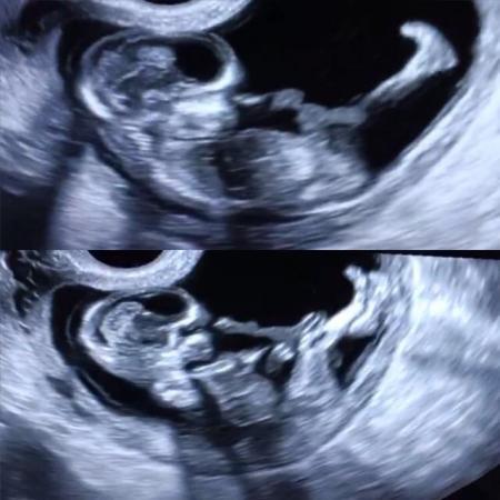 Bild zu Ich bin zurück. - Forum für August - Mamis