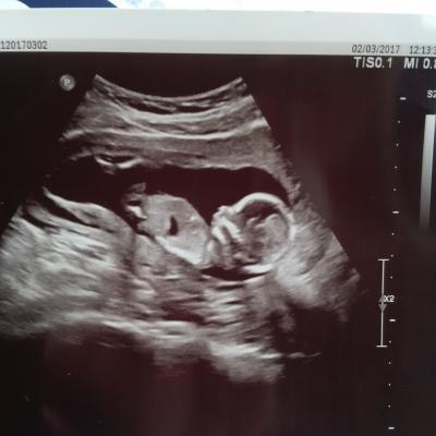 Bild zu zurück vom baby tv :) - Forum für August - Mamis