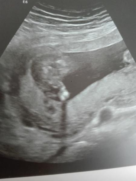 Bild zu Outing - Forum für August - Mamis