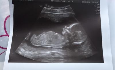 Bild zu Zurück vom fa - Forum für August - Mamis