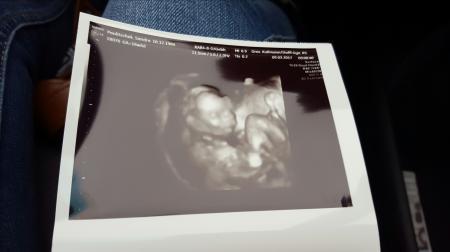 Bild zu Zurück von Frauenarzt - Forum für August - Mamis