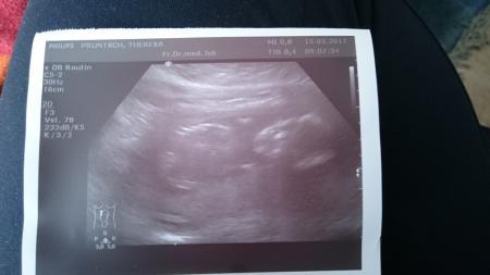 Bild zu Zurück vom FA - Forum für August - Mamis