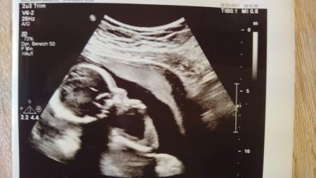 Bild zu Auch zurück vom Frauenarzt - Forum für August - Mamis