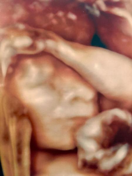 Bild zu Zurück von der Feindiagnostik mit Outing! 💗 - Forum für August - Mamis