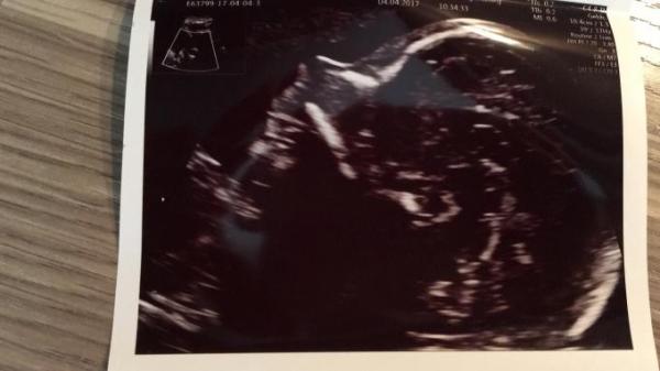 Bild zu Nachhilfe damit was voran geht - Forum für August - Mamis