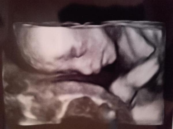 Bild zu Aufregende Woche - Forum für August - Mamis