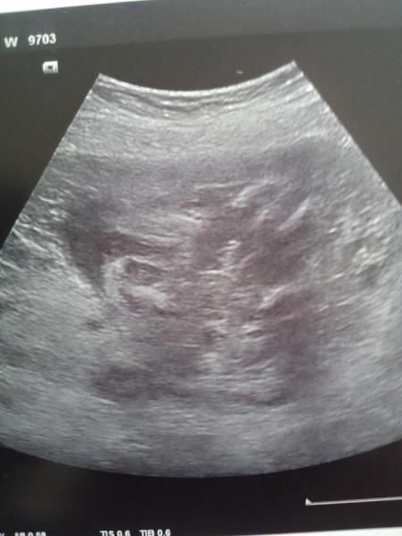 Bild zu Mutterinstinkt mangelhaft... - Forum für August - Mamis