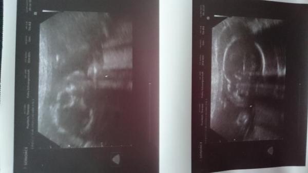 Bild zu 2. Screening - Forum für August - Mamis