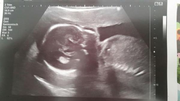 Bild zu Wir gehören zu Team - Forum für August - Mamis