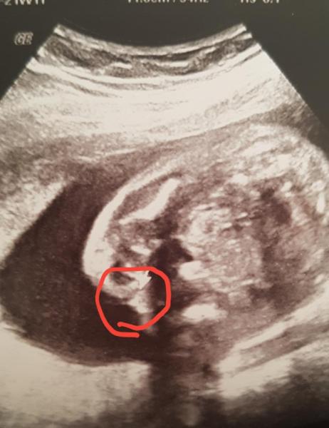 Bild zu Outing?? Wer mag spekulieren - Forum für August - Mamis