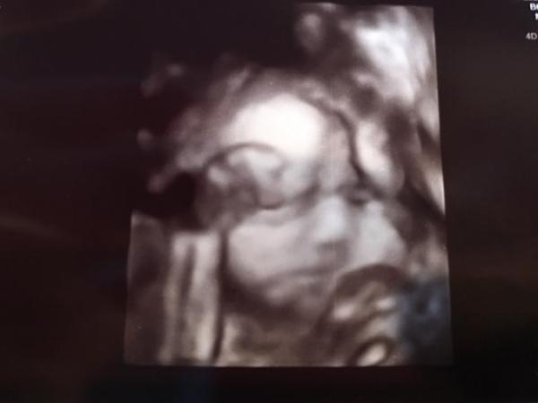 Bild zu Zurück vom FA & Zuckertest - Forum für August - Mamis