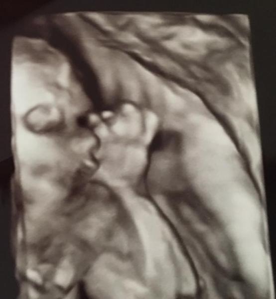 Bild zu FA Termin - Forum für August - Mamis