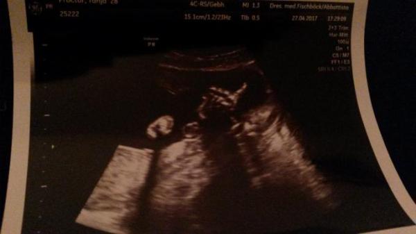 Bild zu Nachtrag - Forum für August - Mamis