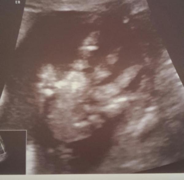 Bild zu Darf ich trotzdem bleiben? :-D - Forum für August - Mamis