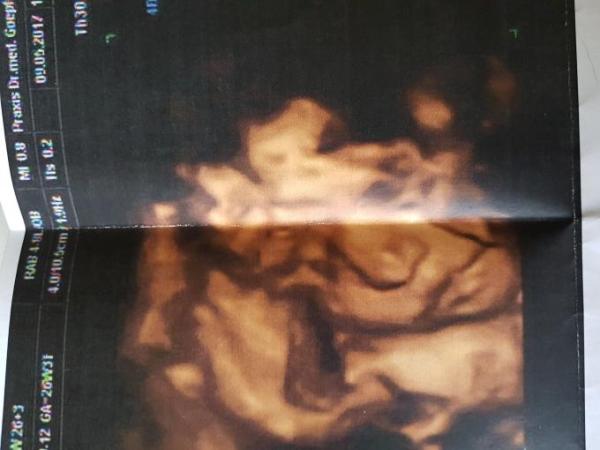 Bild zu Fa Termin heute...... - Forum für August - Mamis