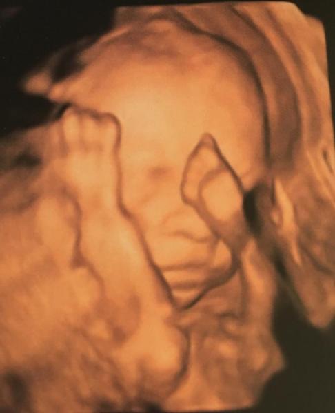 Bild zu FA Termin - Forum für August - Mamis