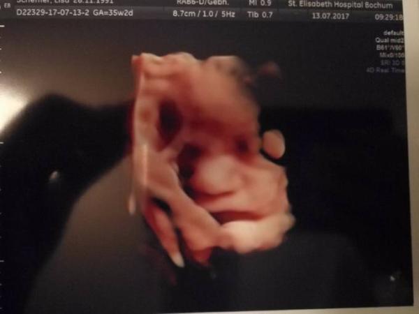 Bild zu Zurück vom Kh - Forum für August - Mamis