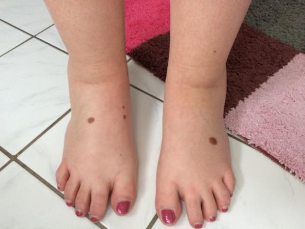 Bild zu Wasser wird immer schlimmer 😩 - Forum für August - Mamis