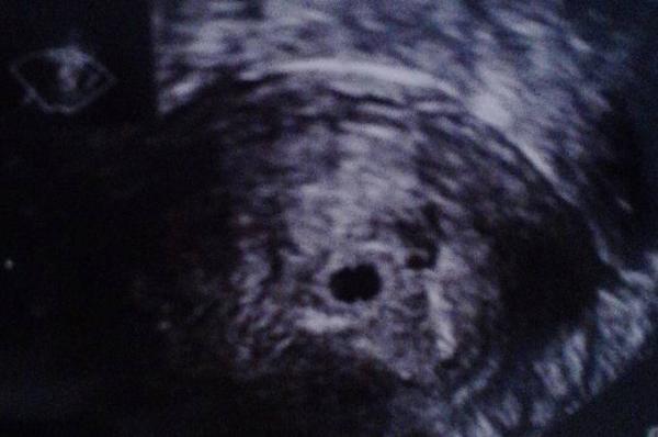 Bild zu Komme grad vom FA.... - Forum für August - Mamis