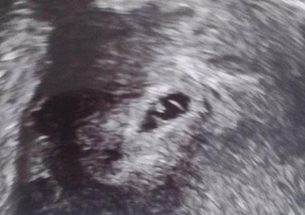 Bild zu Auch zurück vom FA... - Forum für August - Mamis