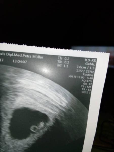 Bild zu Fragen Ultraschall Bild - Forum für August - Mamis