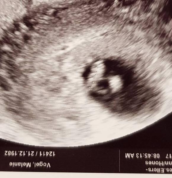Bild zu FA Termin heute - Forum für August - Mamis